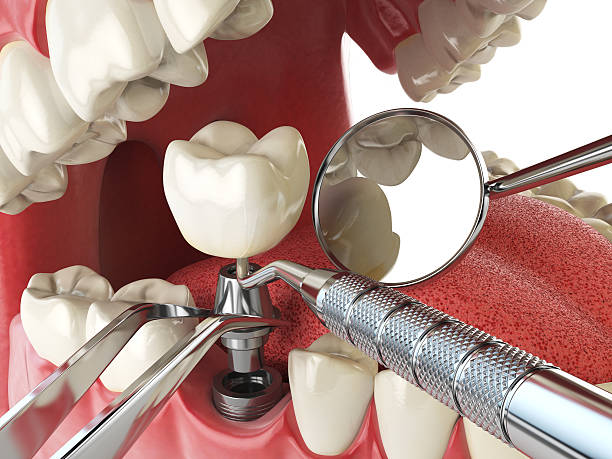 Best Cosmetic Emergency Dentistry in Greer, SC